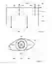 Fig. 02 - Method for determining corneal astigmatism using optical coherence tomography