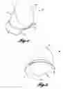 Fig. 02 - Flexible gonioscopic lens