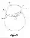 Fig. 07 - Flexible gonioscopic lens