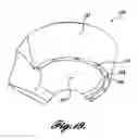 Fig. 12 - Flexible gonioscopic lens