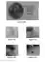 Fig. 13 - ELECTRONICS FOR DETECTION OF A CONDITION OF TISSUE