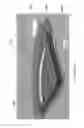 Fig. 25 - ELECTRONICS FOR DETECTION OF A CONDITION OF TISSUE