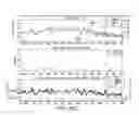 Fig. 46 - SENSOR SYSTEMS, DEVICES, AND METHODS FOR CONTINUOUS GLUCOSE MONITORING