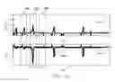 Fig. 89 - SENSOR SYSTEMS, DEVICES, AND METHODS FOR CONTINUOUS GLUCOSE MONITORING