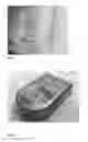 Fig. 02 - Implantable sensor apparatus and methods