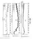 Fig. 45 - Sensor systems, devices, and methods for continuous glucose monitoring
