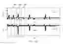 Fig. 89 - Methods, systems, and devices for sensor fusion