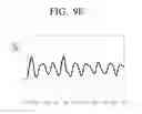 Fig. 14 - Oxygen saturation measuring apparatus and oxygen saturation measuring method thereof