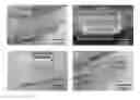 Fig. 01 - Appendage mountable electronic devices conformable to surfaces