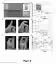 Fig. 06 - Appendage mountable electronic devices conformable to surfaces