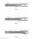 Fig. 03 - ENDOVASCULAR CYTOLOGY BRUSH AND METHOD FOR USE