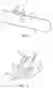 Fig. 07 - Implantable sealable member with mesh layer