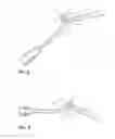 Fig. 06 - METHOD AND APPARATUS FOR PASSING SUTURE THROUGH TISSUE