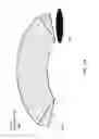 Fig. 35 - TRANSOSTEAL ANCHORING METHODS FOR TISSUE REPAIR