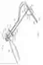 Fig. 02 - Surgical fastening