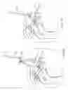 Fig. 06 - Surgical fastening