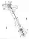 Fig. 02 - ENDOSCOPIC PURSE STRING SURGICAL DEVICE