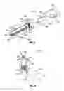 Fig. 03 - ENDOSCOPIC PURSE STRING SURGICAL DEVICE