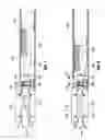 Fig. 07 - ENDOSCOPIC PURSE STRING SURGICAL DEVICE
