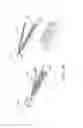 Fig. 16 - DELIVERY APPLICATOR FOR RADIOACTIVE STAPLES FOR BRACHYTHERAPY MEDICAL TREATMENT