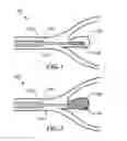 Fig. 02 - Shape memory polymer foams for endovascular therapies