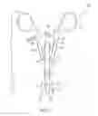 Fig. 02 - Bone centering drill guide