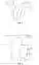 Fig. 03 - Methods and systems for preparing bone for a surgical procedure