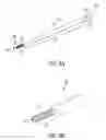 Fig. 07 - Methods and systems for preparing bone for a surgical procedure