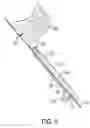 Fig. 08 - Methods and systems for preparing bone for a surgical procedure