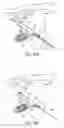 Fig. 10 - Methods and systems for preparing bone for a surgical procedure