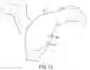 Fig. 13 - Methods and systems for preparing bone for a surgical procedure
