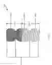 Fig. 35 - VASCULAR TREATMENT DEVICES