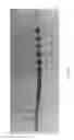 Fig. 89 - VASCULAR TREATMENT DEVICES