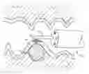 Fig. 01 - Expandable scaffolds for submucosal tissue separation