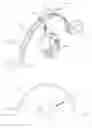 Fig. 02 - Device and method for follicular unit transplantation
