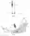 Fig. 07 - Spinous process plate fixation assembly