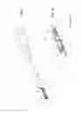 Fig. 04 - Fixing device for a surgical anchor member