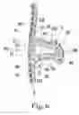 Fig. 07 - General anatomic self-locking plate for medial acetabulum and auxiliary apparatus thereof