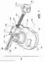 Fig. 02 - Mechanised bone cement delivery system with a valve that closes to stop the flow of pressurized cement