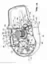 Fig. 05 - Mechanised bone cement delivery system with a valve that closes to stop the flow of pressurized cement