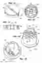 Fig. 09 - Mechanised bone cement delivery system with a valve that closes to stop the flow of pressurized cement