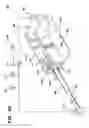 Fig. 23 - Mechanised bone cement delivery system with a valve that closes to stop the flow of pressurized cement