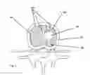 Fig. 02 - Multi-probe system using bipolar probes and methods of using the same