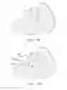 Fig. 05 - Radio frequency ablation cooling shield