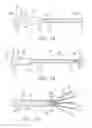 Fig. 11 - Radio frequency ablation cooling shield