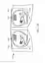 Fig. 22 - Quantitative three-dimensional imaging and printing of surgical implants