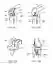 Fig. 32 - Quantitative three-dimensional imaging and printing of surgical implants