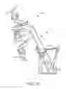 Fig. 10 - Limited movement of a surgical mounting platform controlled by manual motion of robotic arms