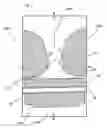 Fig. 07 - Ornament for Attachment to Orthodontic Braces