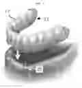 Fig. 08 - POP-A-DENTURE